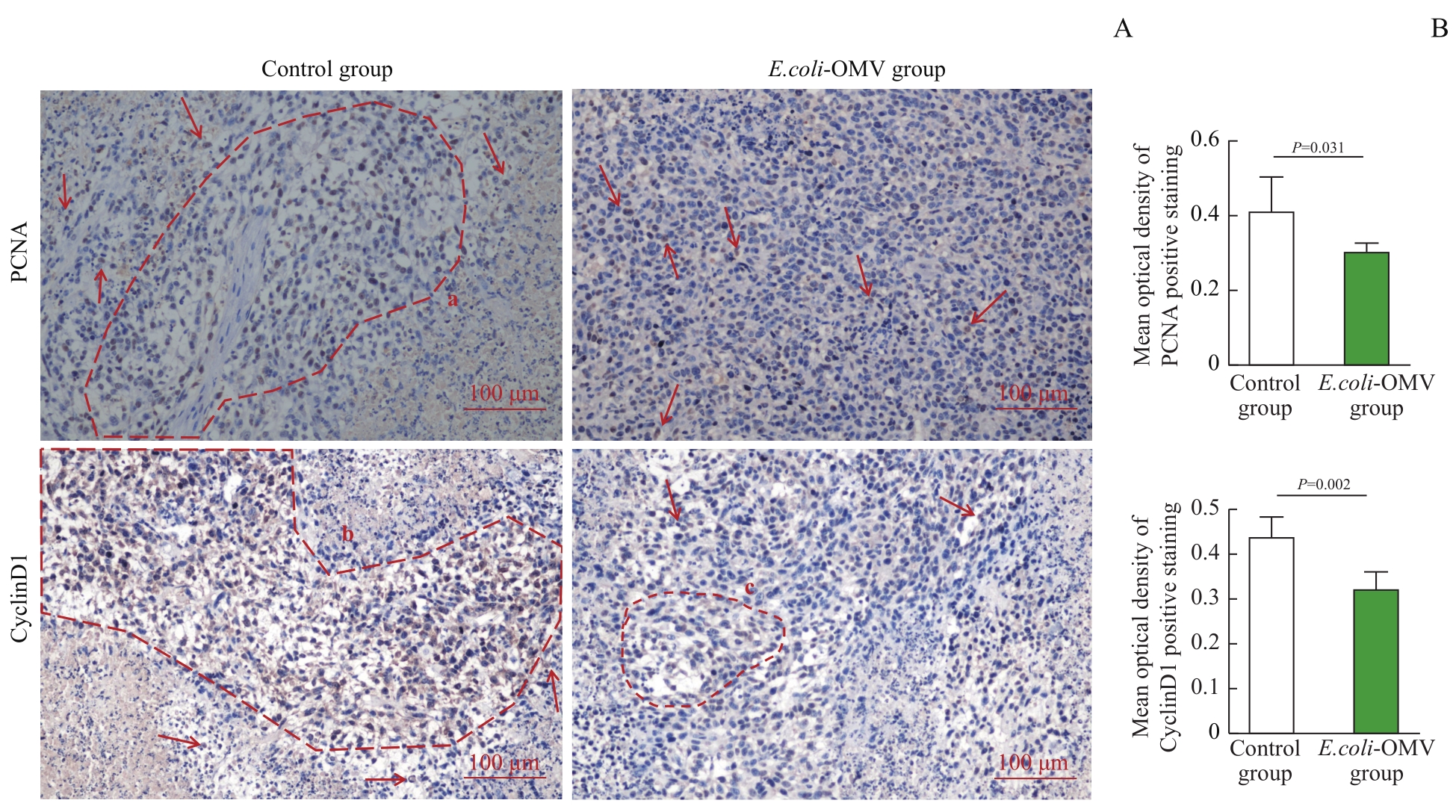 大肠埃希菌外膜囊泡对乳腺癌细胞增殖及荷瘤小鼠肿瘤生长的影响